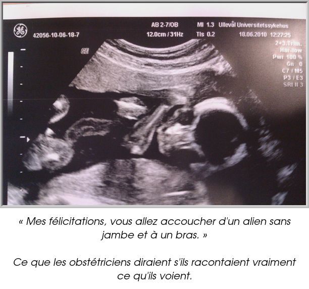 « Mes félicitations, vous allez accoucher d'un alien sans jambe et à un bras. »

Ce que les obstétriciens diraient s'ils racontaient vraiment ce qu'ils voient.