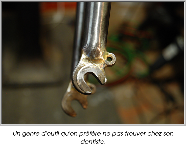 Un genre d'outil qu'on préfère ne pas trouver chez son dentiste.