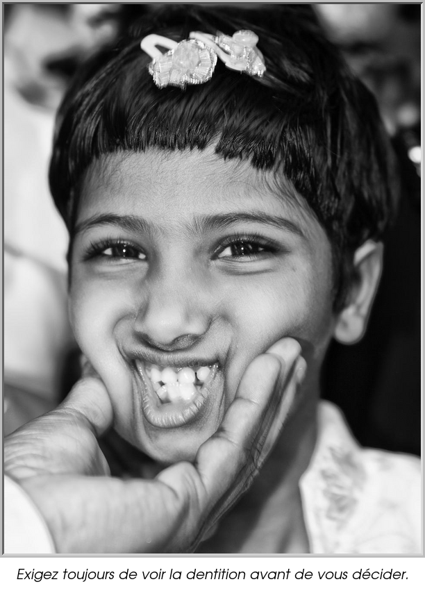 Exigez toujours de voir la dentition avant de vous décider.